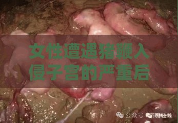 女性遭遇猪鞭入侵子宫的严重后果及常见症状解析：如何识别与应对这一罕见事件